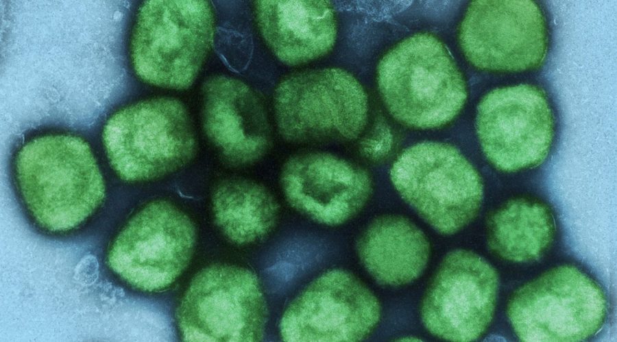 Μπορεί η ευλογιά των πιθήκων να εξελιχθεί σε πανδημία; Τι εκτιμά κορυφαίος βρετανός ειδικός | Ygeiaonline